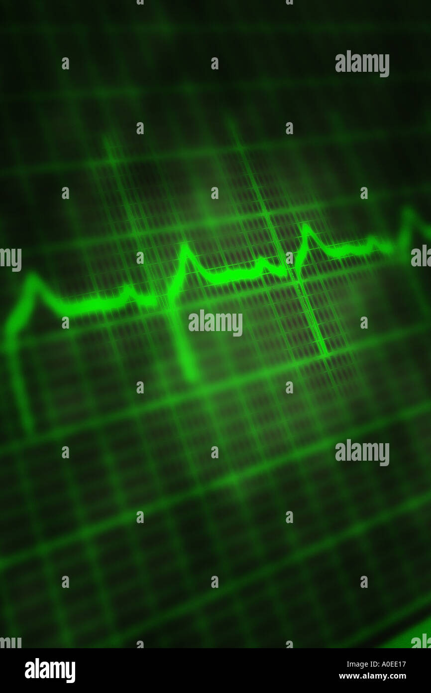 Ekg readout hi-res stock photography and images - Alamy