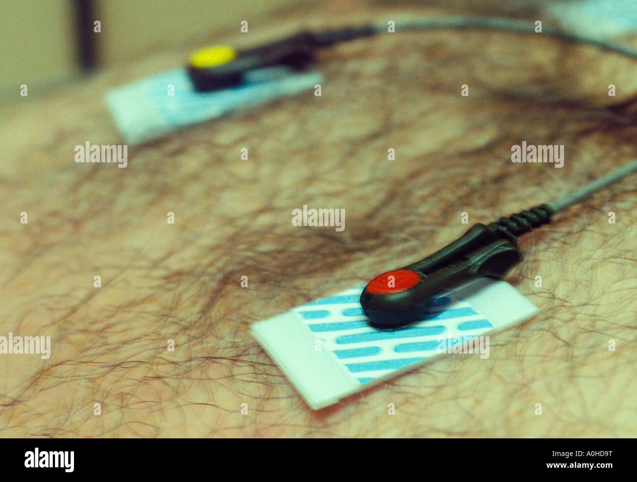 Doctor's Office Man Having an EKG Closeup Bare Chest Stock Photo Alamy