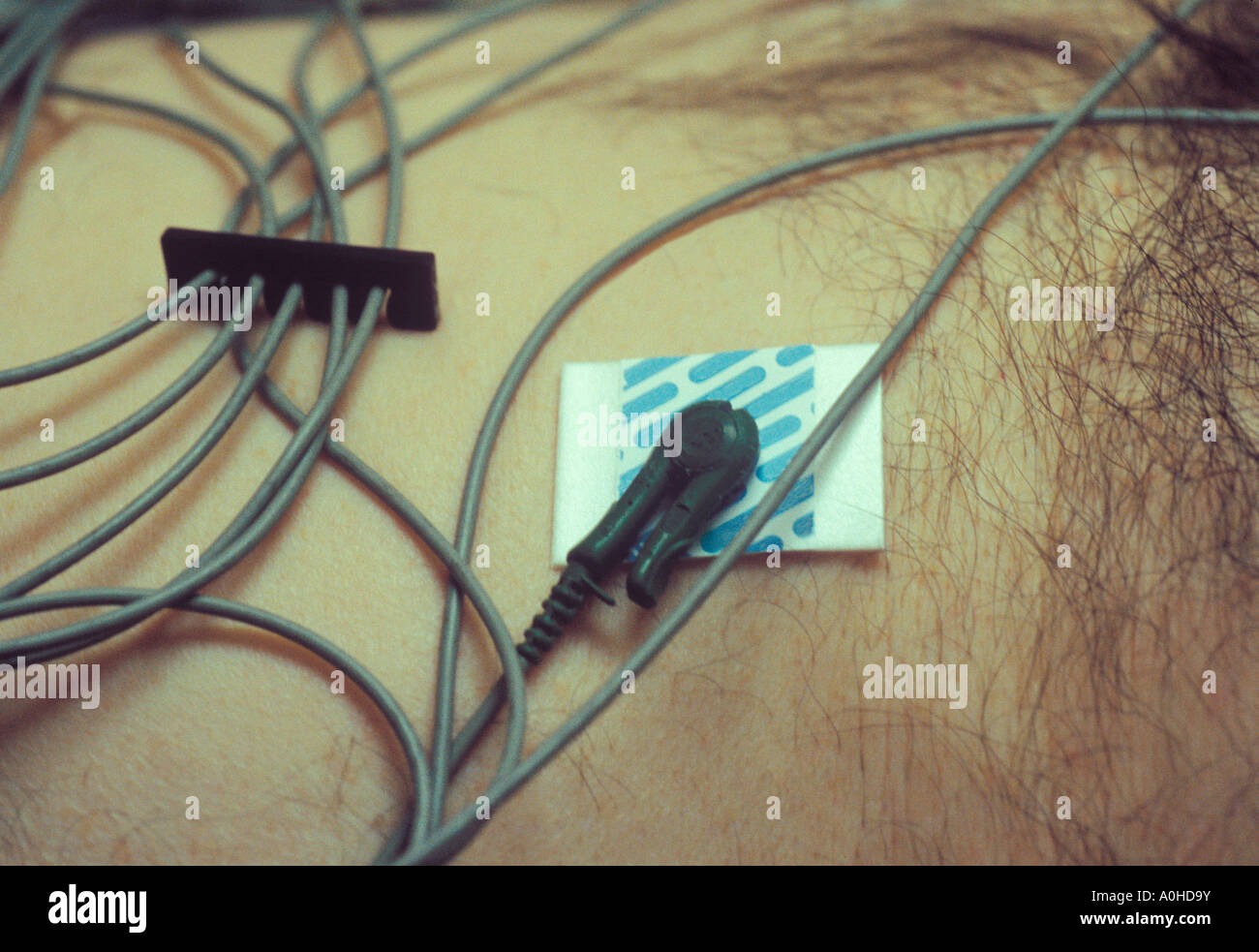 Doctor's Office Male Patient Having an EKG Closeup Bare Chest ECG