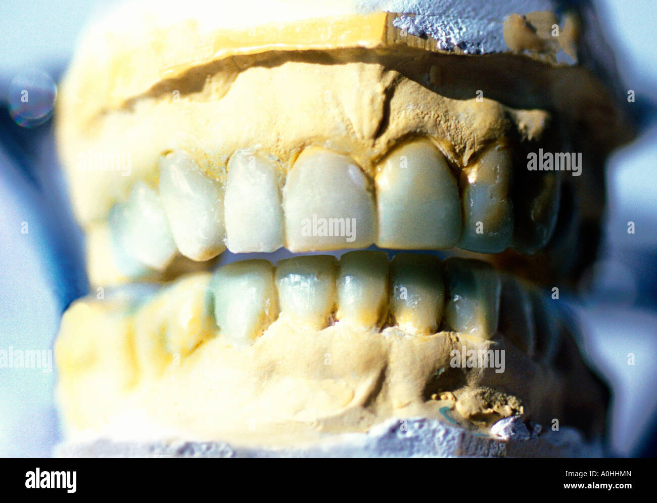 Dentist's Mold of Teeth Stock Photo Alamy