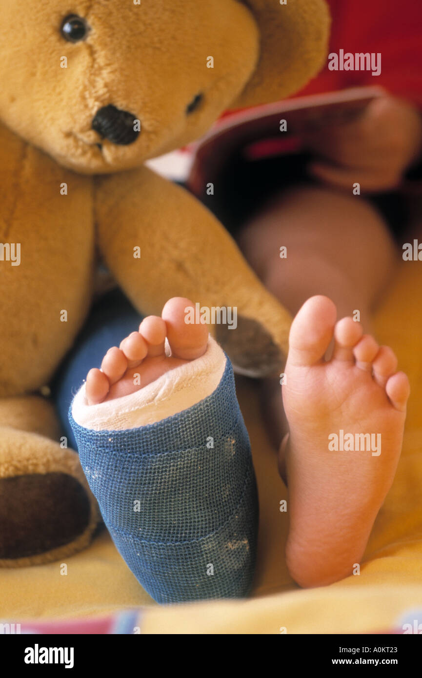 teddy bear with cast on leg