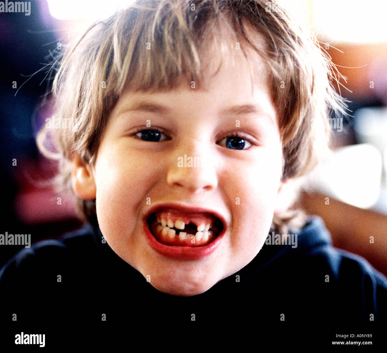 Milk Teeth Stock Photo - Alamy