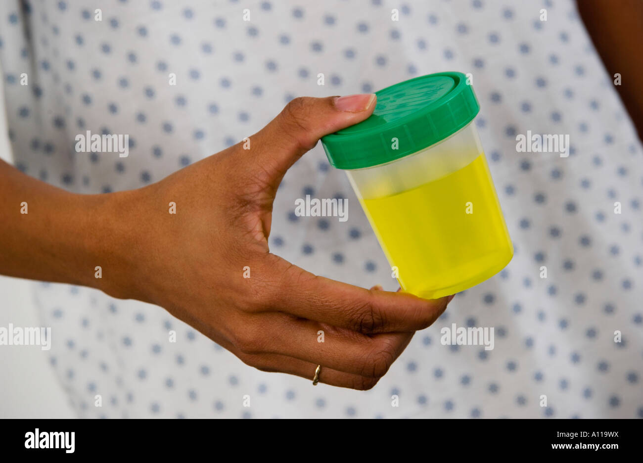 Patient holding urine sample Stock Photo Alamy