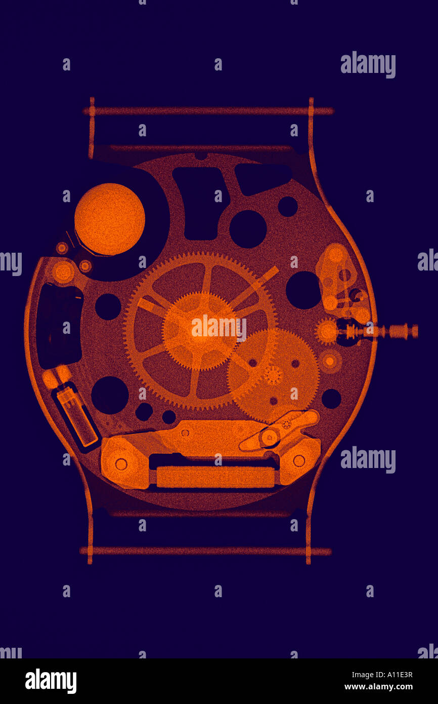 An X-ray photograph of a plastic watch-case (Swatch). Radiographie d'une montre à boîtier plastique (Swatch). Stock Photo