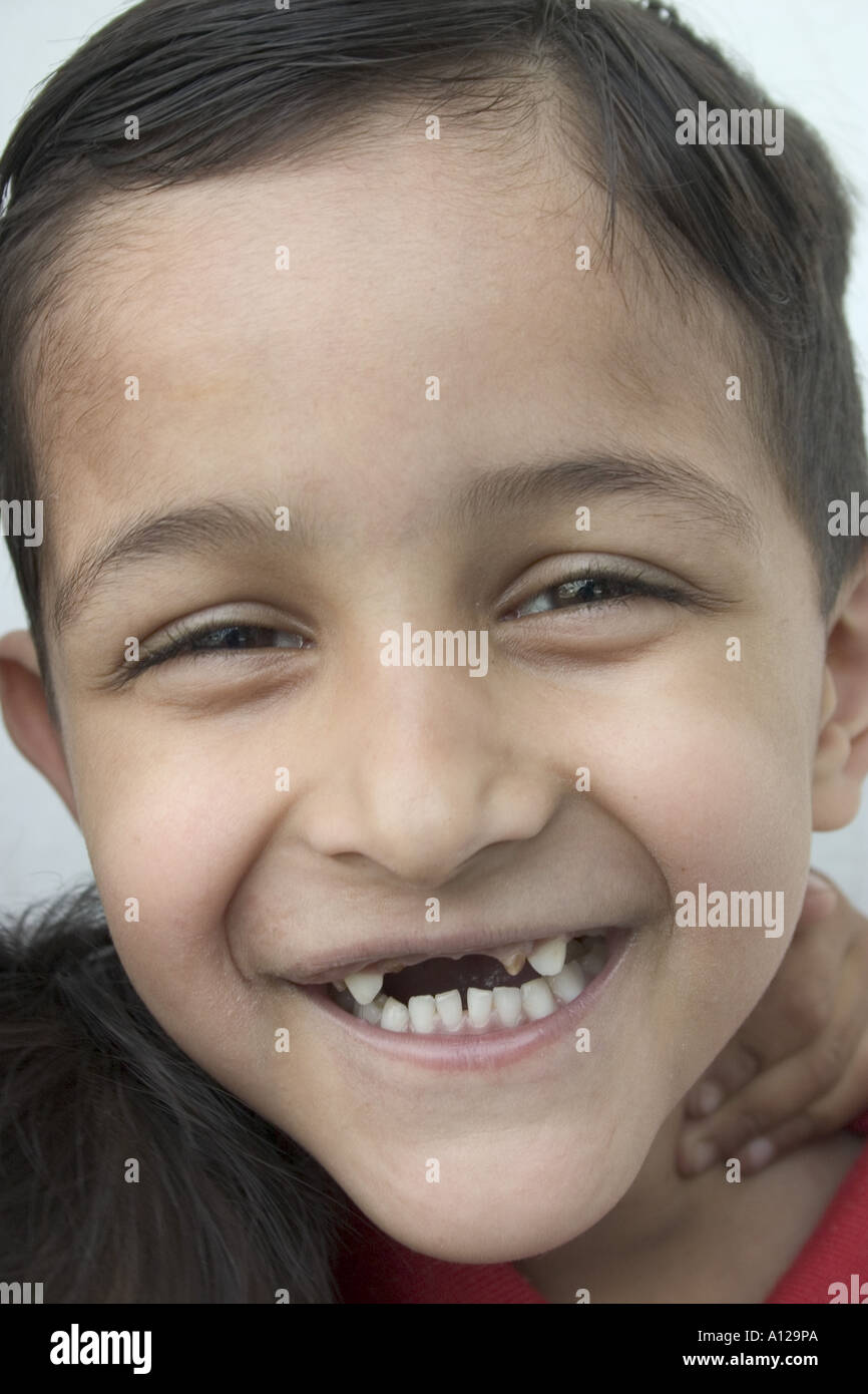 Boy smiling showing broken teeth Dehradun Uttranchal India Model released No 542 Stock Photo