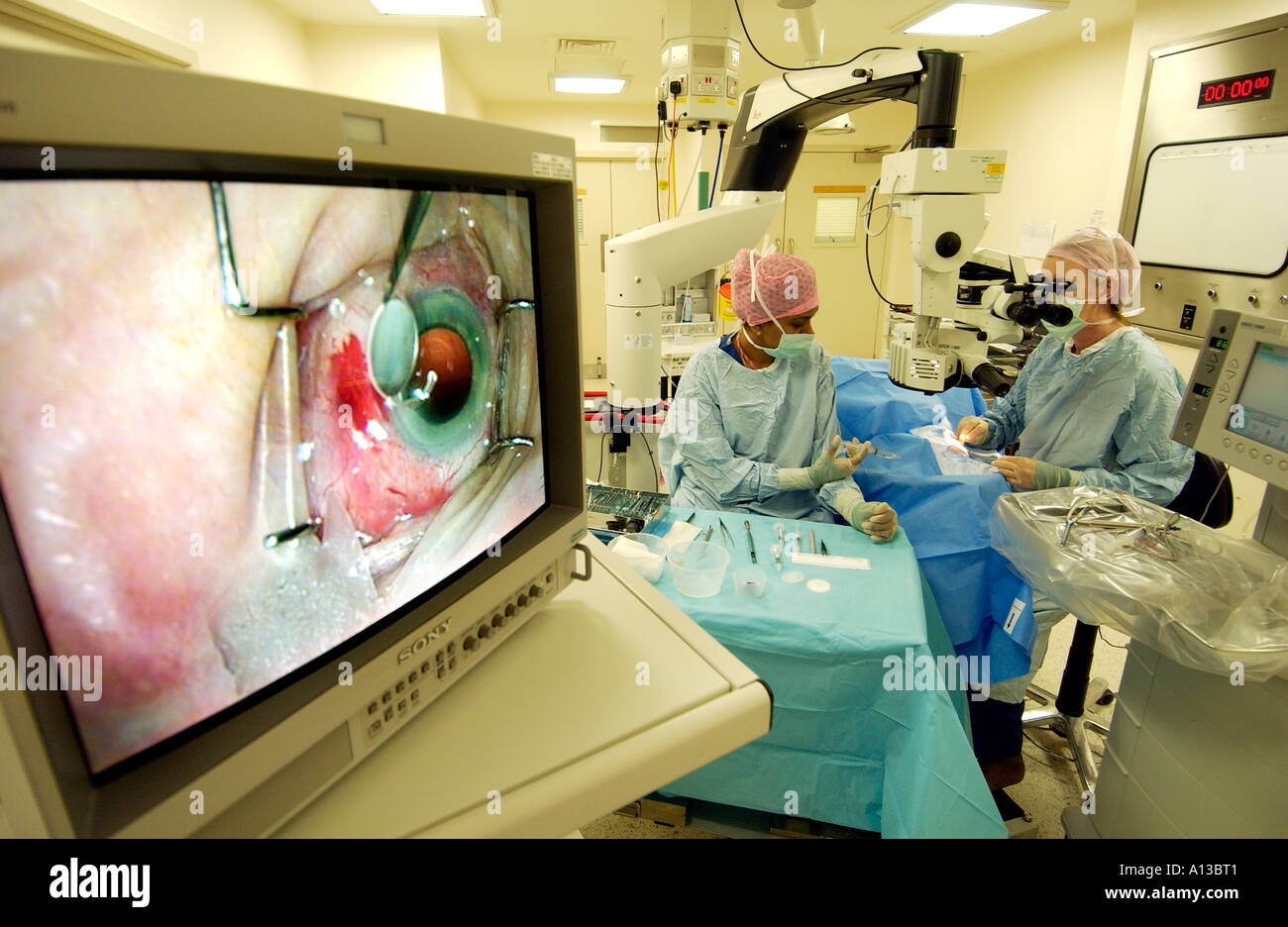 Cataract operation seen in close up on operating theatre screen with woman doctor and nurse behind. Stock Photo