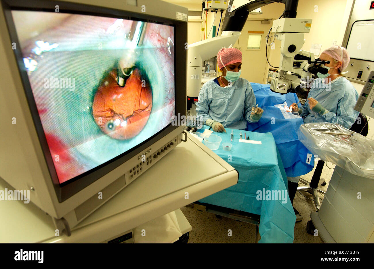 Cataract operation seen in close up on operating theatre screen with woman doctor and nurse behind. Stock Photo