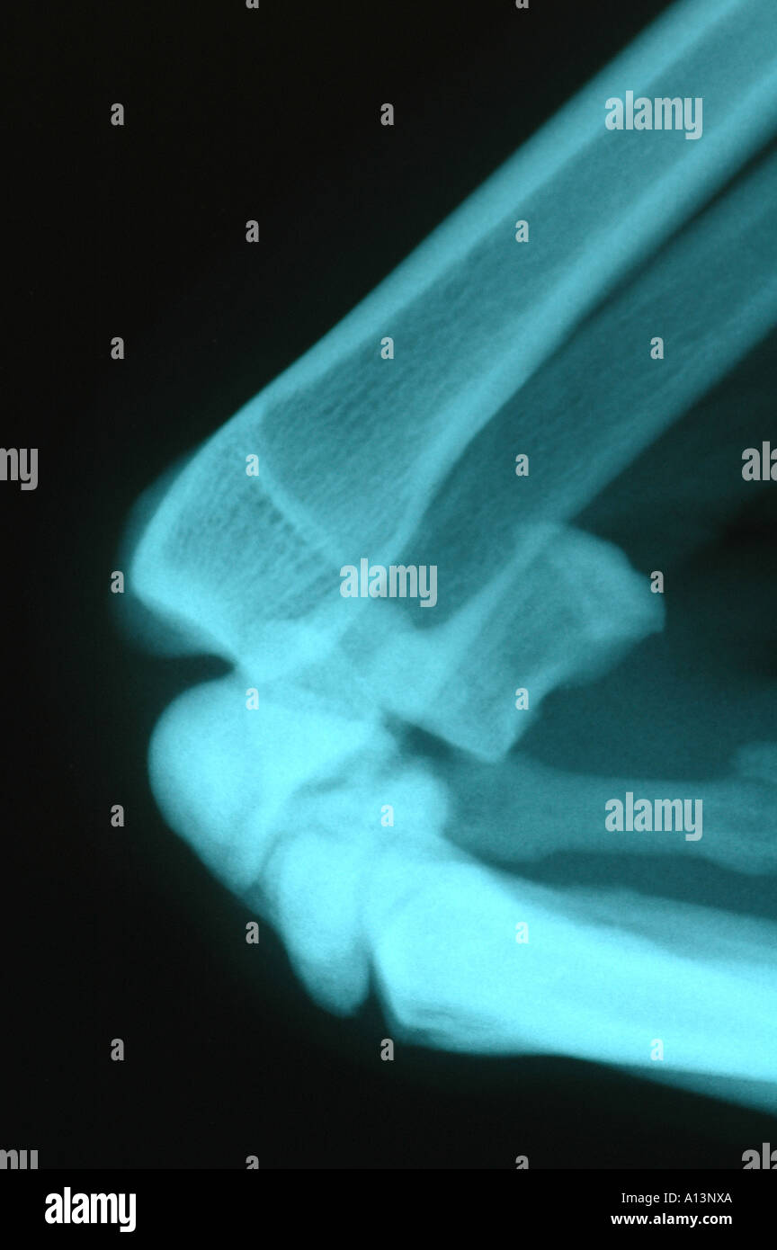 Carpus joint dog hires stock photography and images Alamy