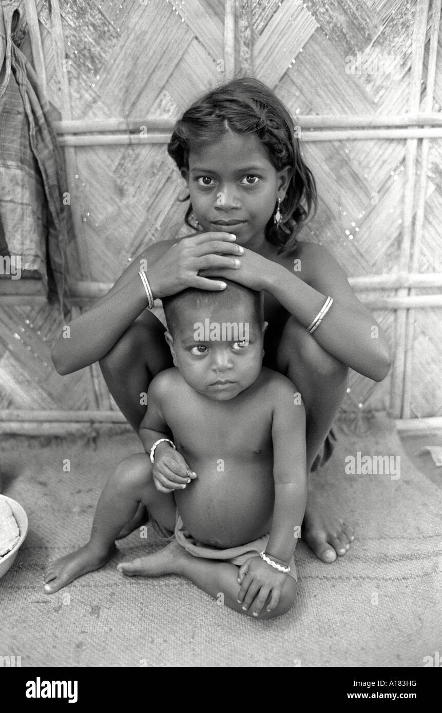 B/W of children at an emergency rural health clinic and feeding centre  for sick and malnourished children. Noapara, Nr Kolkata, West Bengal, India Stock Photo
