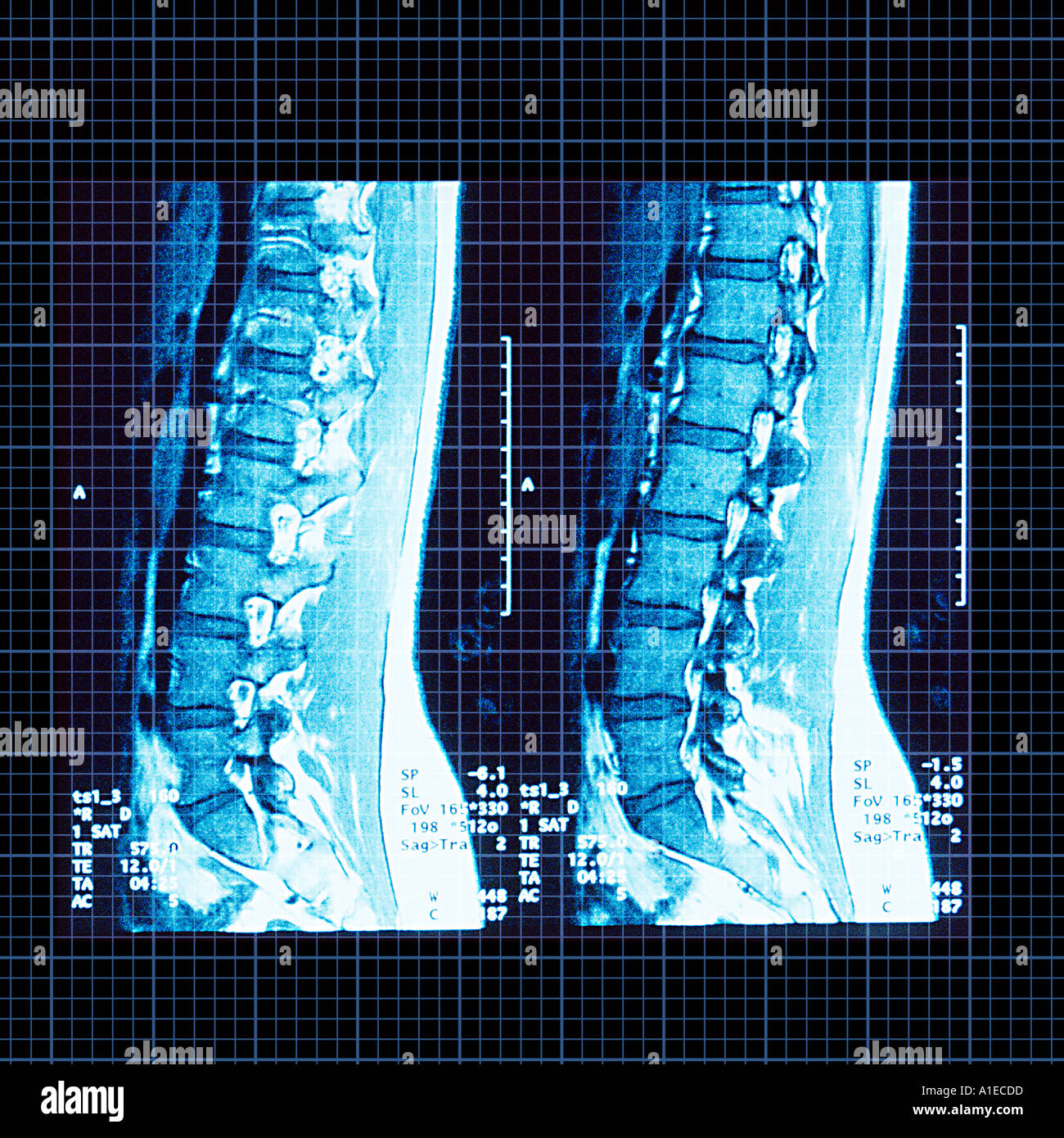 back x rays Stock Photo Alamy