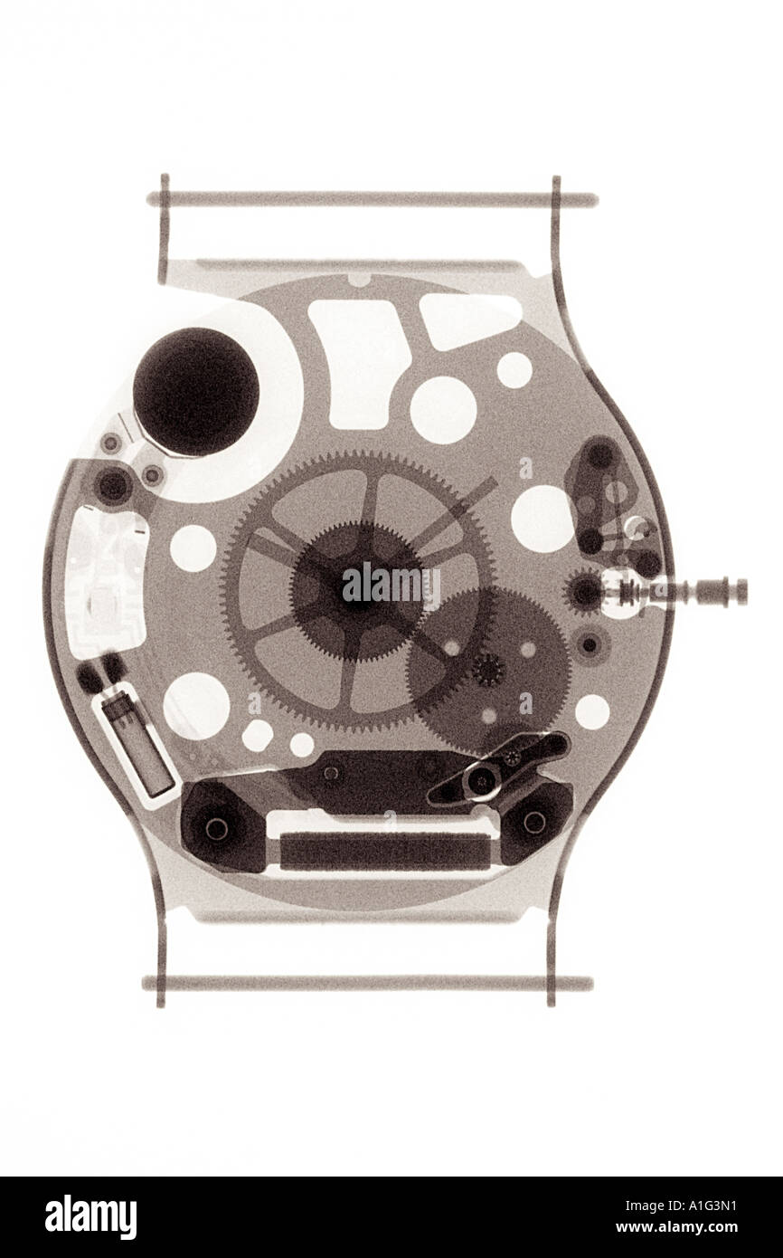 An X-ray photograph of a watch in a plastic watch-case. Monochromatic picture.  radiograph xray xrays x rays x-rays. Stock Photo