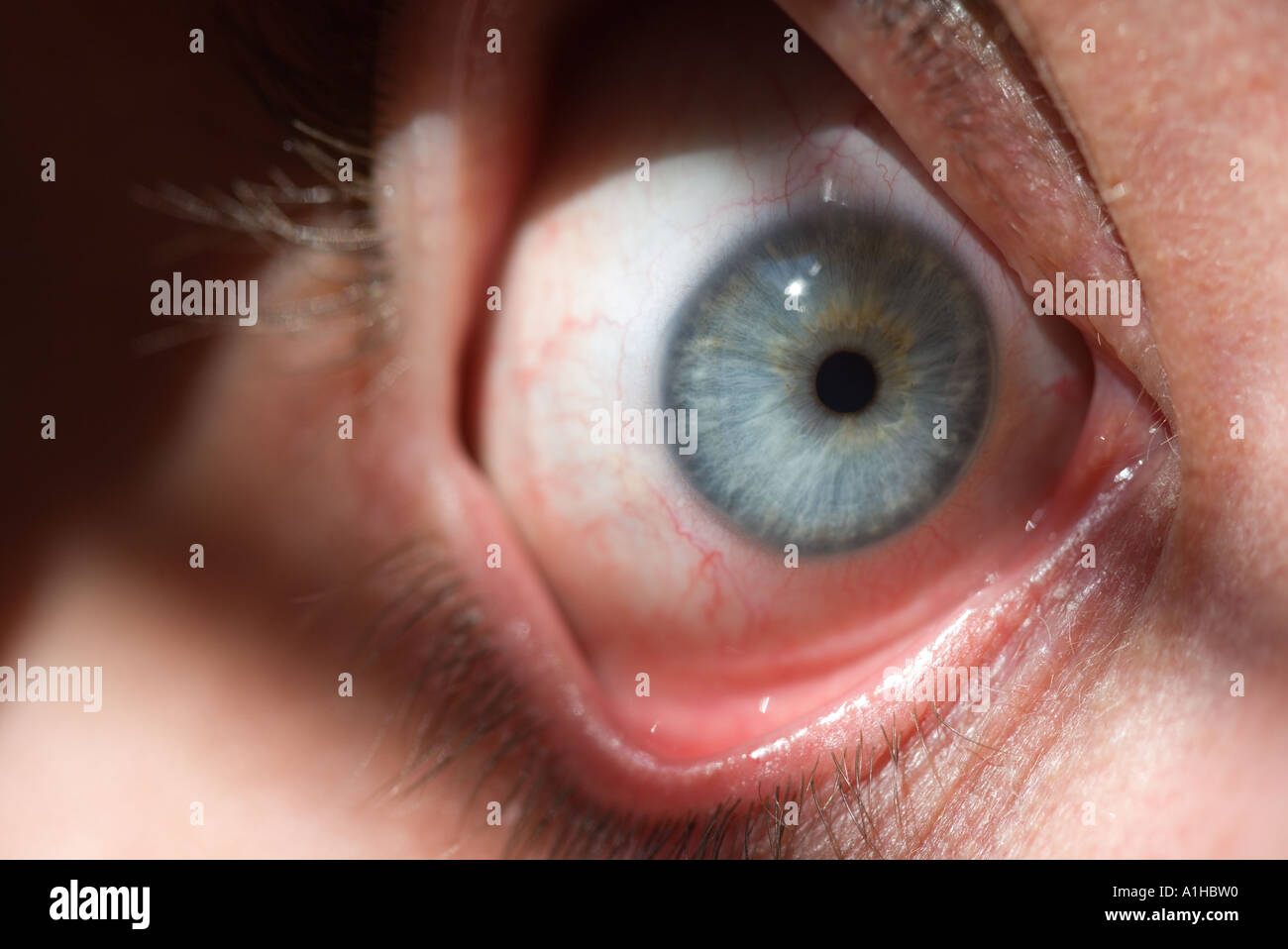 Eyeball spread open Stock Photo Alamy
