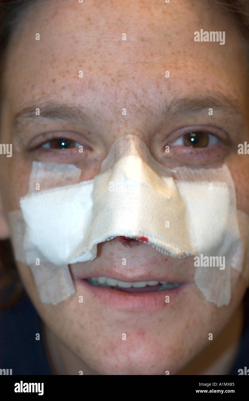 Dog bite wound hires stock photography and images Alamy