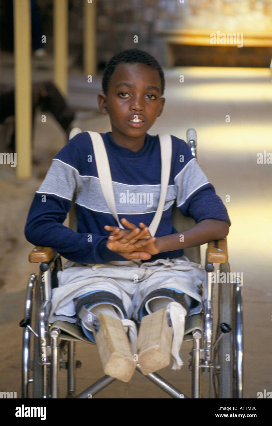 RETURN TO RWANDA MARCH 1995 CHILD MINE VICTIM KIGALI CENTRAL HOSPITAL Stock Photo