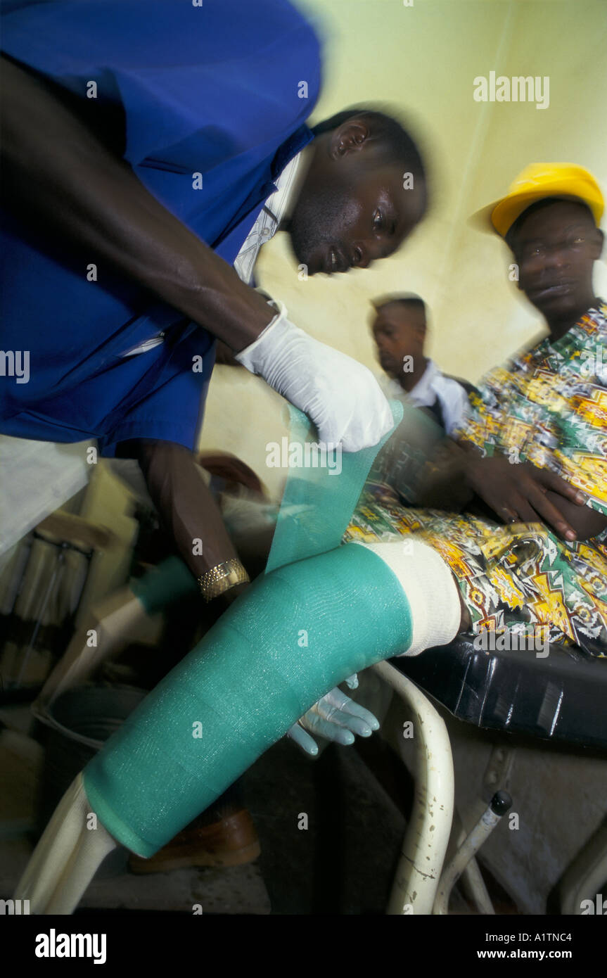 FITTING FALSE LEGS IN RWANDA MARCH 1995 Stock Photo - Alamy