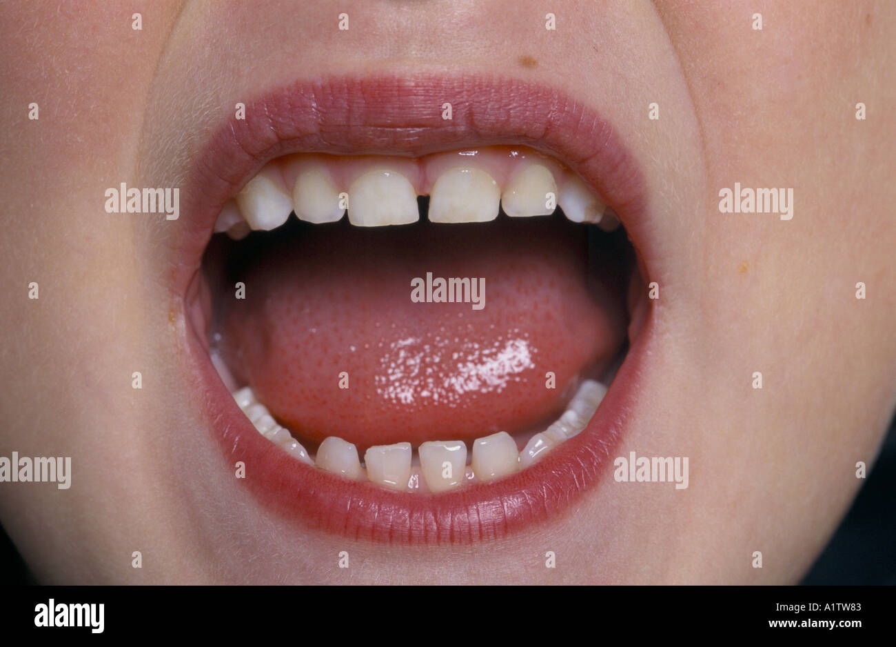 HEALTHY TEETH OF A 5 YEAR OLD CHILD Stock Photo Alamy
