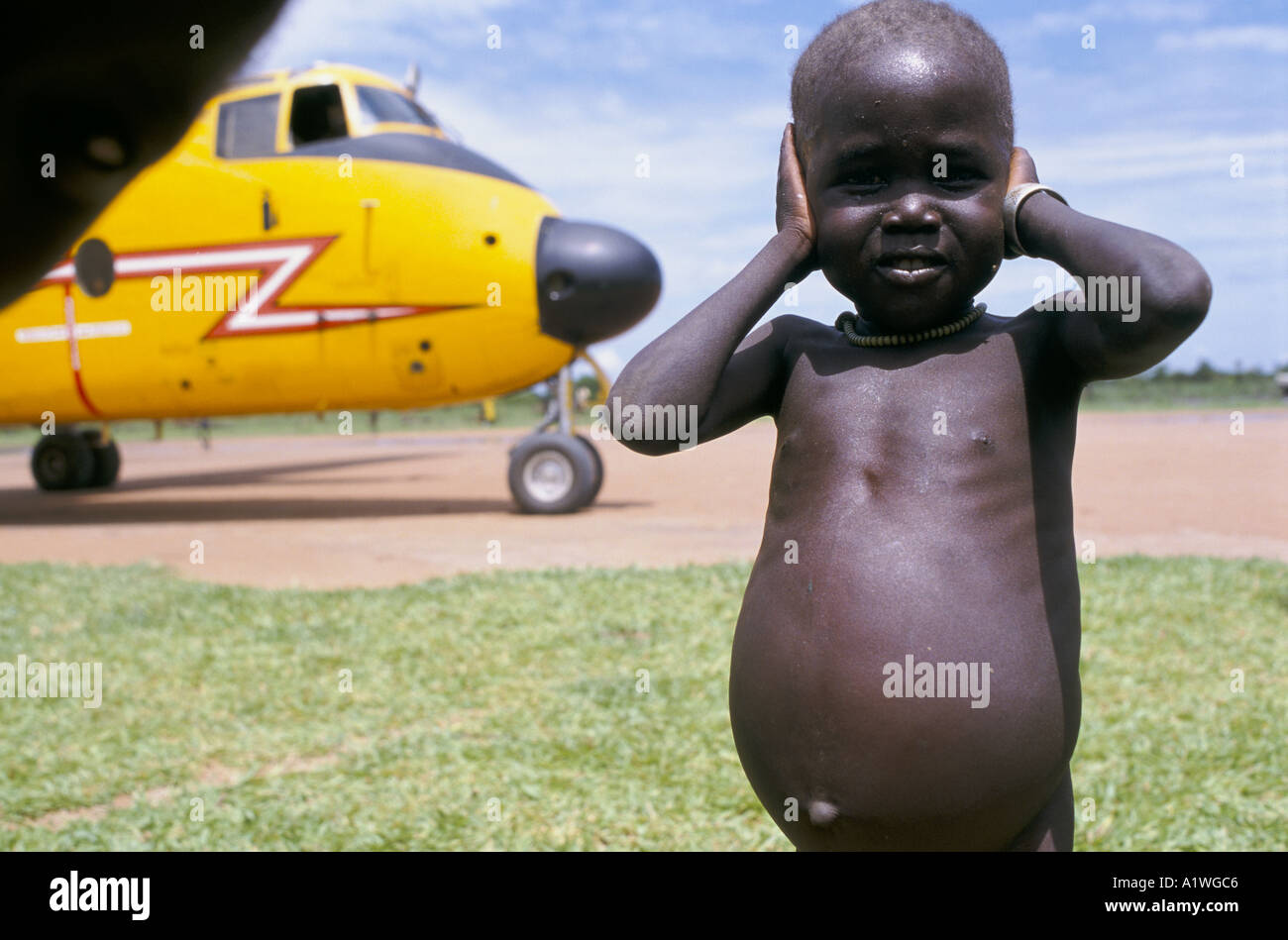 SOUTH SUDAN AUGUST 1998 FAMINE. MALNOURISHED CHILD SHIELDS HIS EARS