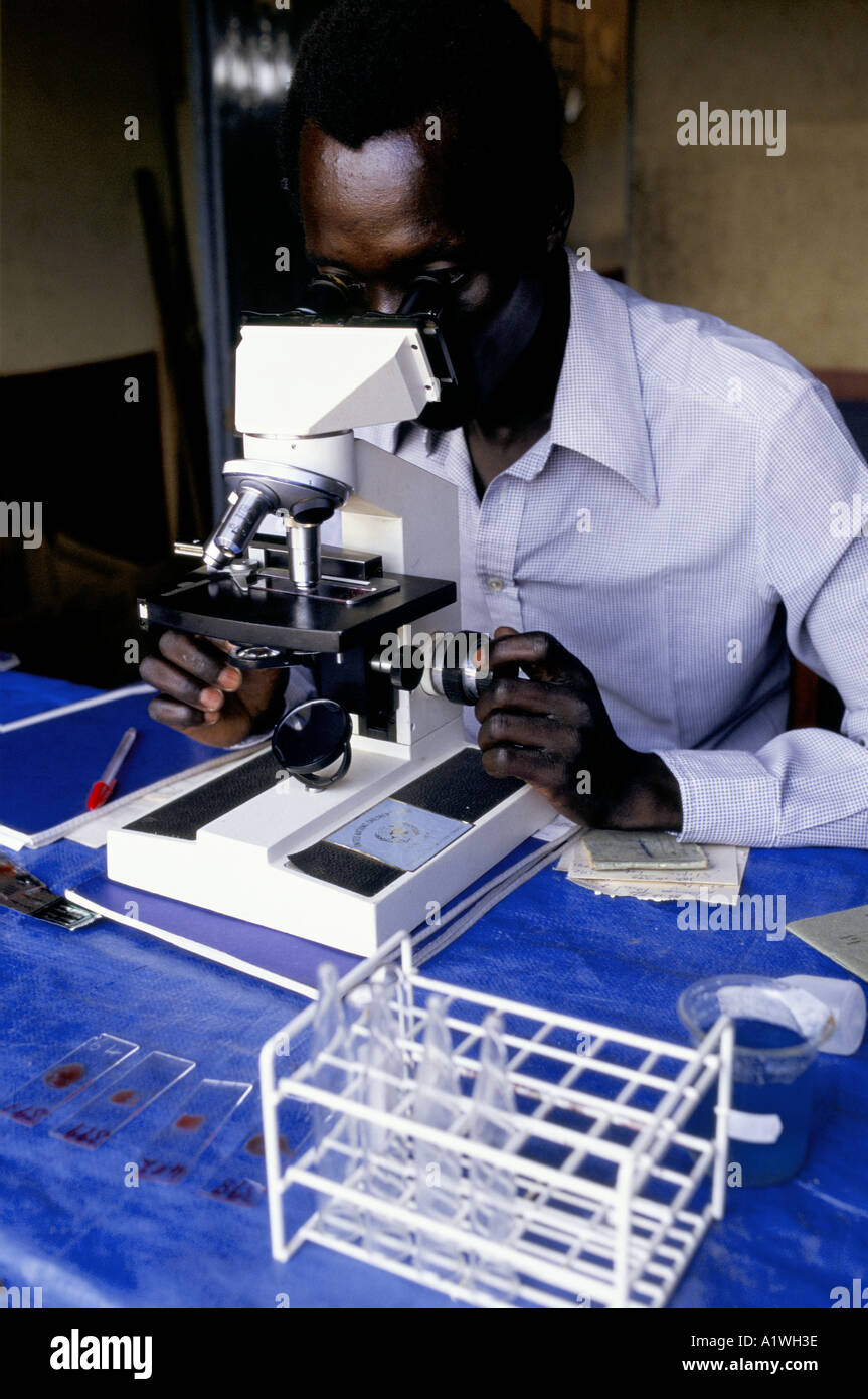 MAN LOOKING THROUGH MICROSCOPE IN YOYO DISPENSARY LAB TESTING FOR MALARIA IKAFE UGANDA 1996 Stock Photo