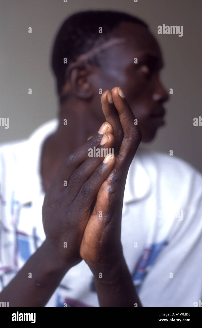 Machete wounds hires stock photography and images Alamy