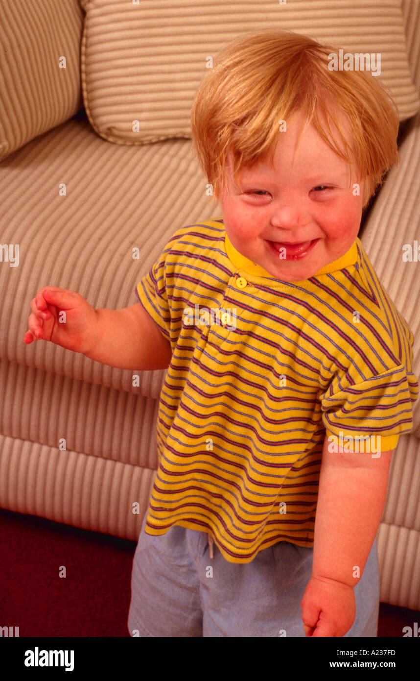Portrait of 2 year old boy with Down syndrome Stock Photo