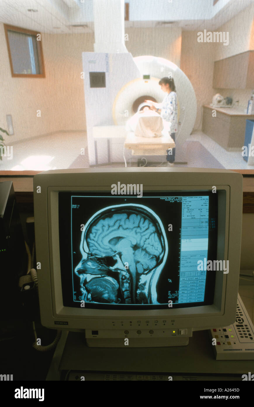 SCREEN SHOWING BRAIN OF PATIENT BEING SCANNED Stock Photo - Alamy