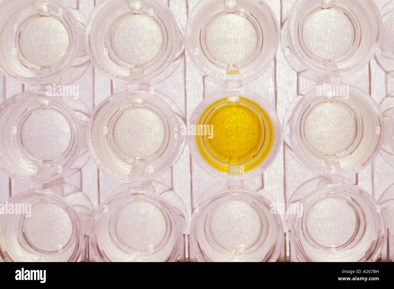Postive Labratory Test Positive result, Yellow Dot, in a group of HIV tests in a hospital ...