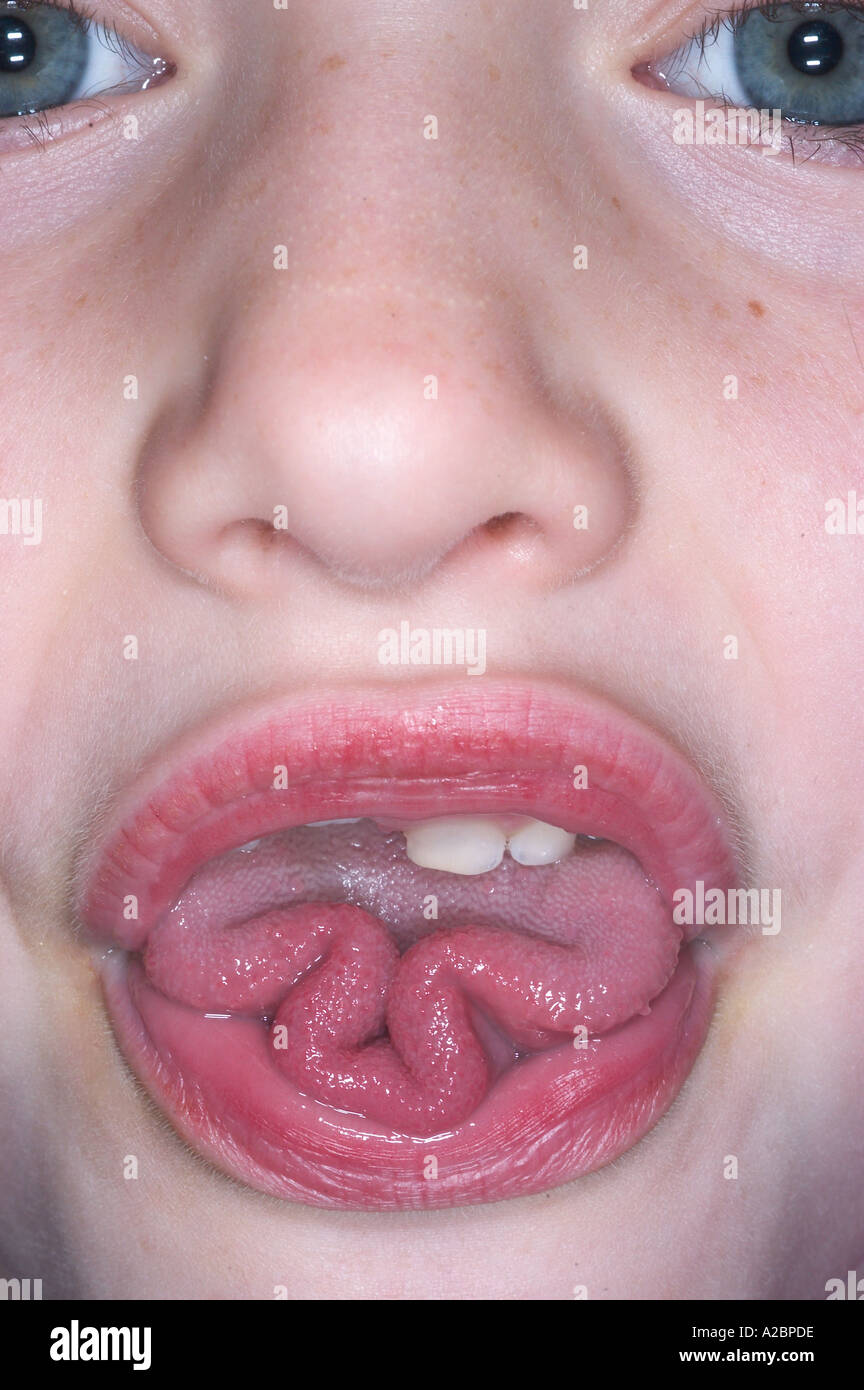 tongue rolling is a controlled trait Stock Photo 3418845