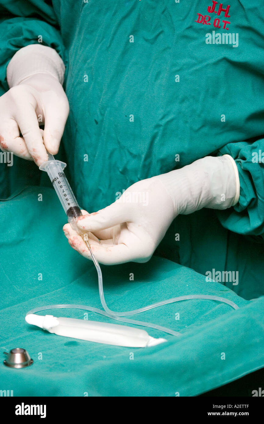 A surgeon at work in a hospital Stock Photo