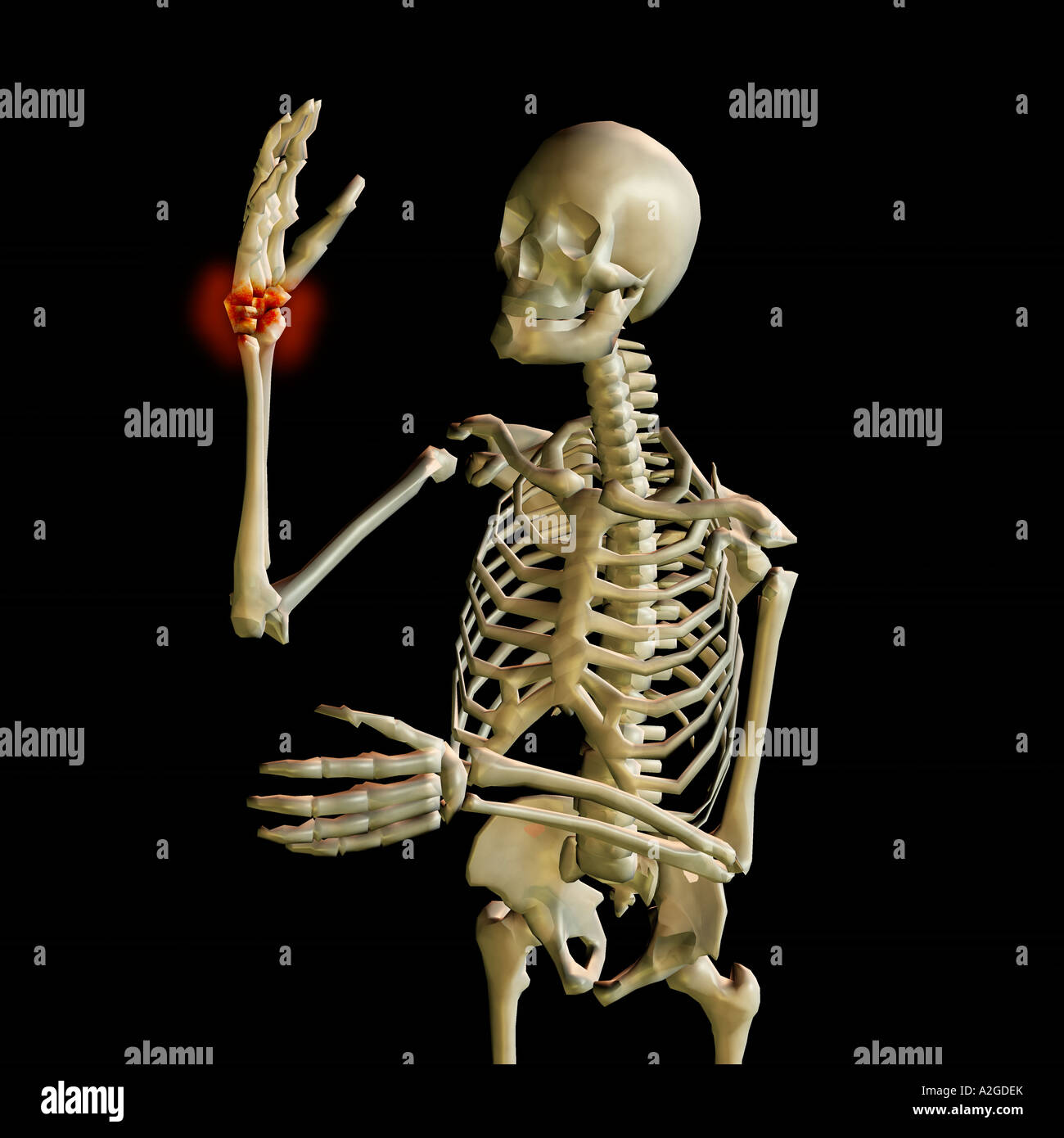 Skeleton illustrating Wrist Pain Stock Photo - Alamy