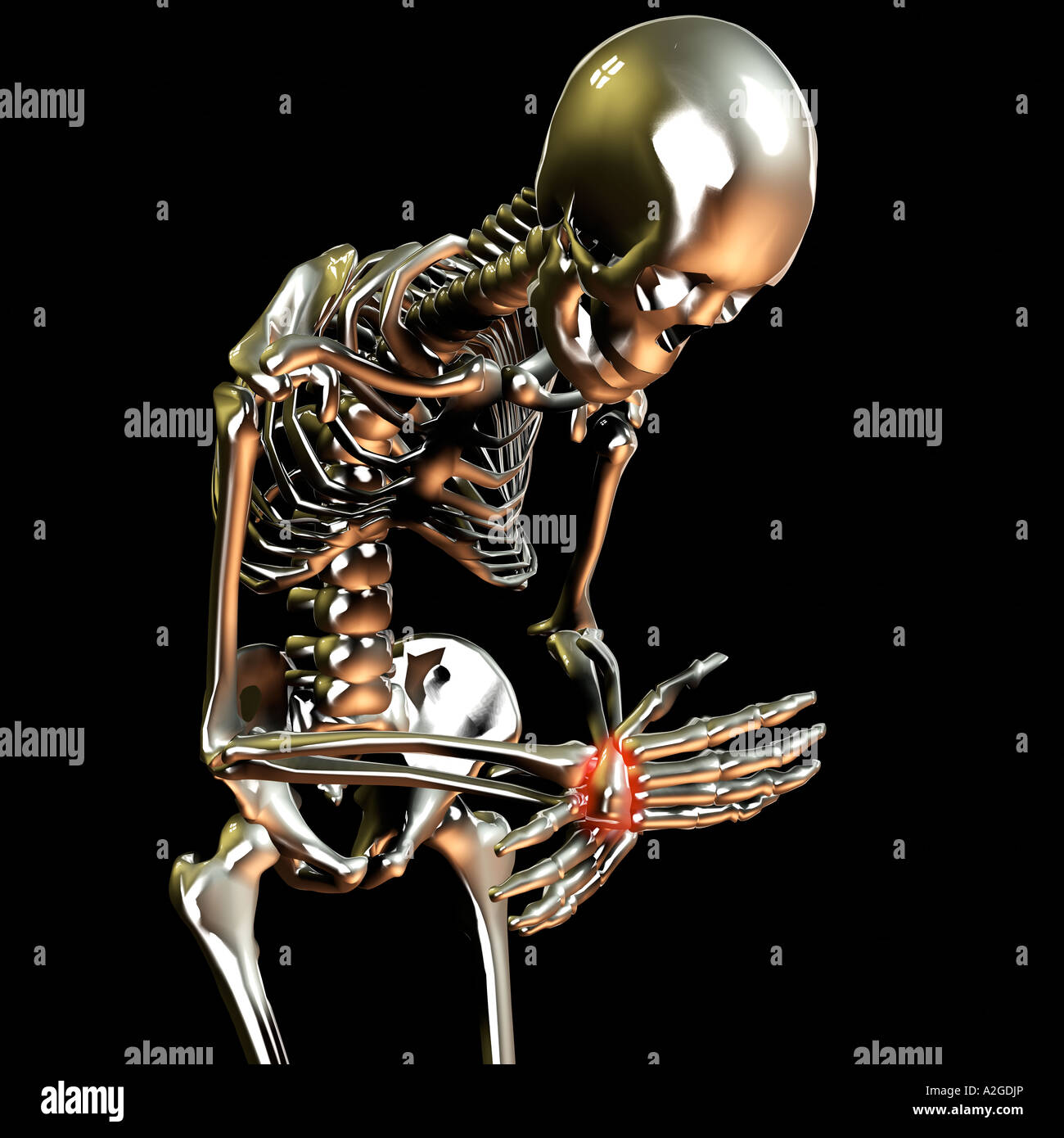 Skeleton Illustrating Joint Pain Stock Photo