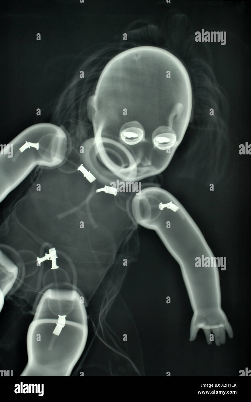 xray of a doll Stock Photo Alamy