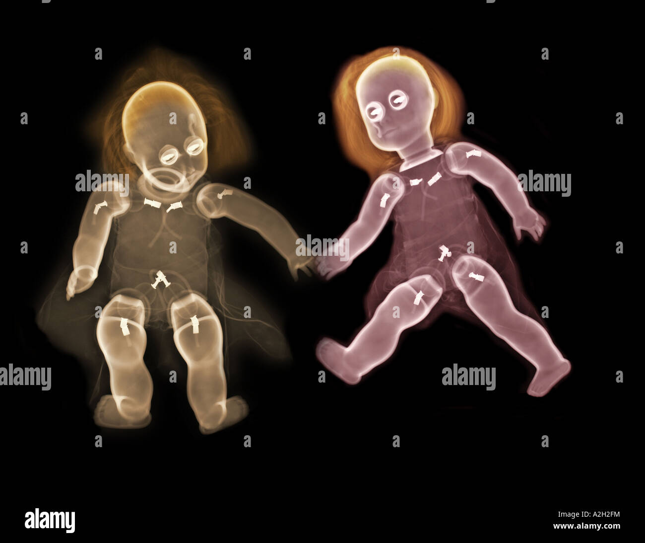 colorized xray of a childs dolls Stock Photo Alamy