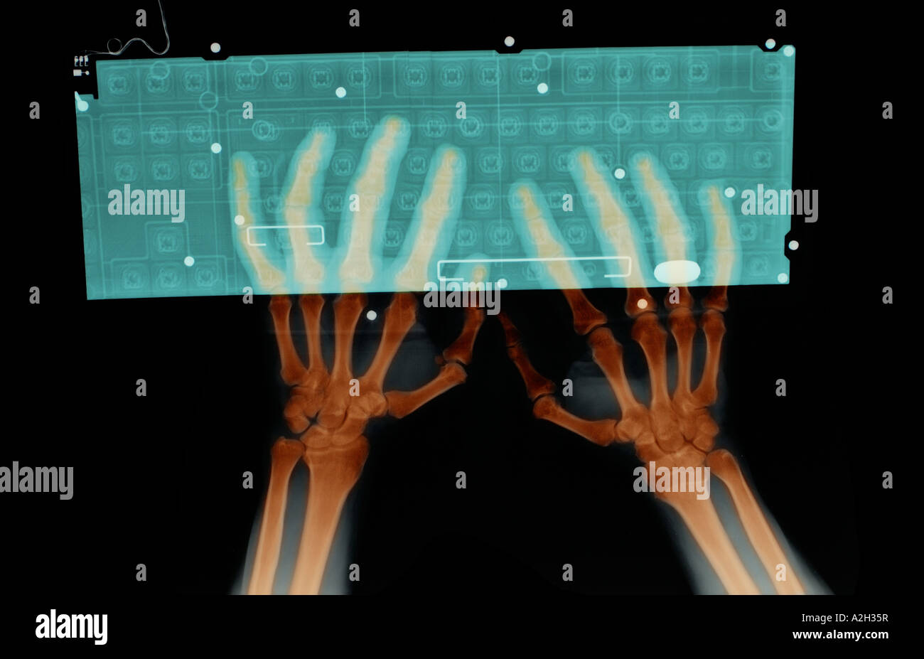 colorized xray of a person typing at a computer keyboard Stock Photo