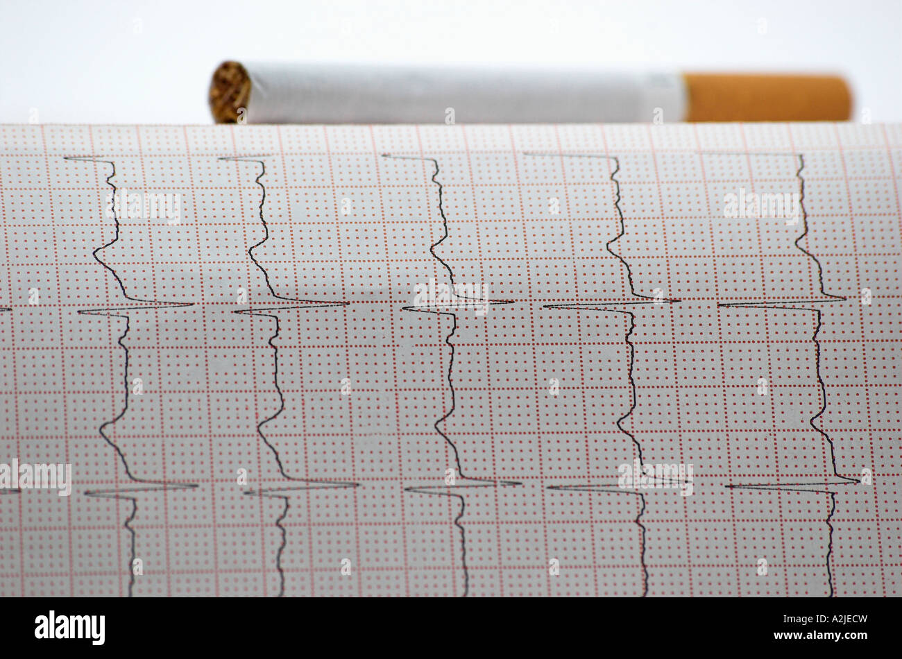 Ecg test hi-res stock photography and images - Alamy Ecg test hi-res stock photography and images - Alamy
