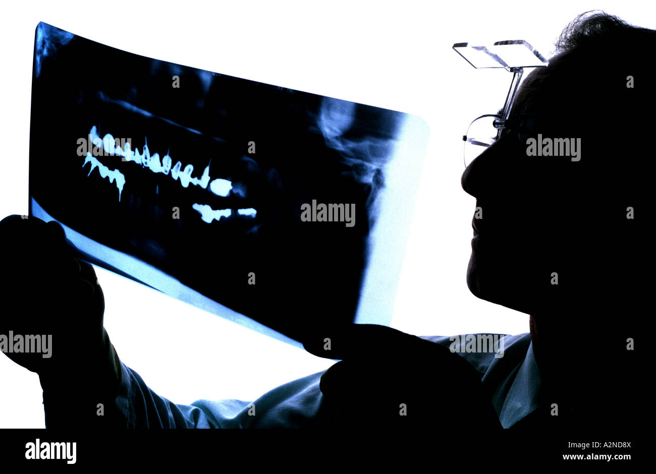 Dentist x ray nhs hires stock photography and images Alamy