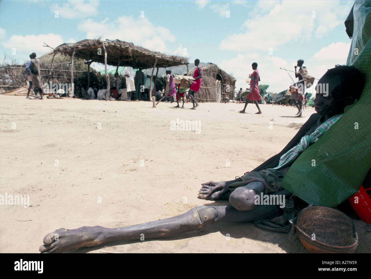 starving man el muglad famine camp s cordofan sudan oct 1988 Stock Photo