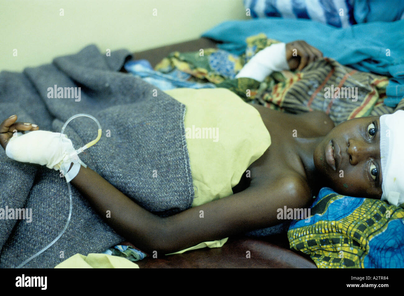 Machete wound hires stock photography and images Alamy