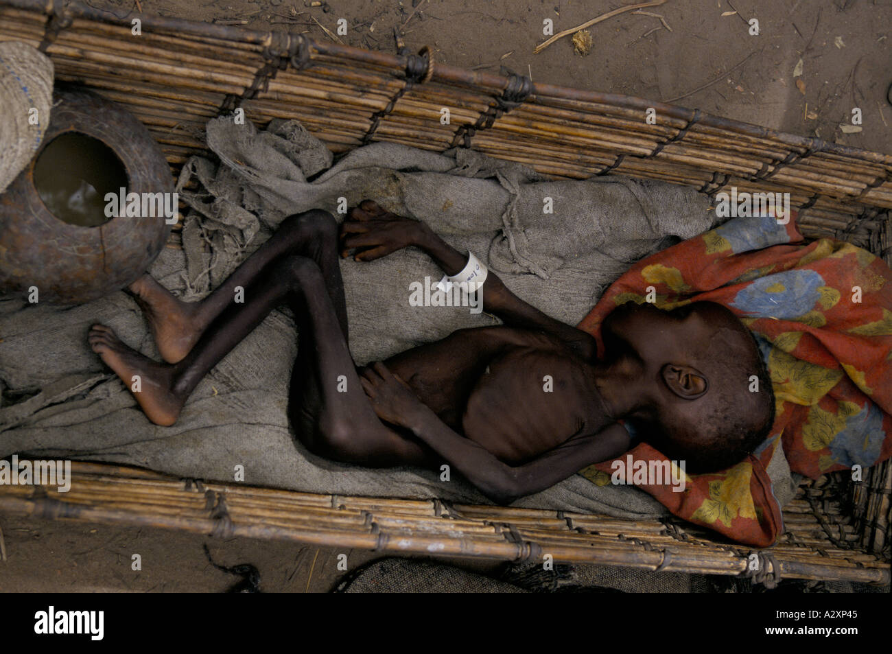 Ageip, Southern Sudan: An starving child lies in a bamboo cot wearing an arm band after being registered for food aid by MSF Stock Photo