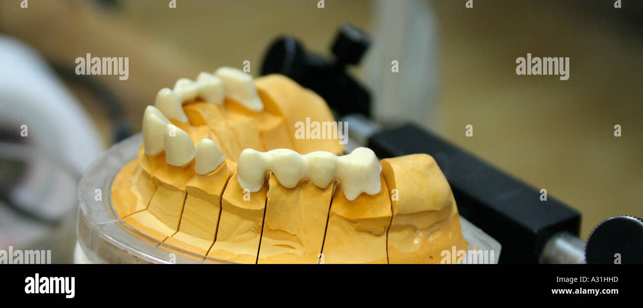 Impression of teeth close up Stock Photo