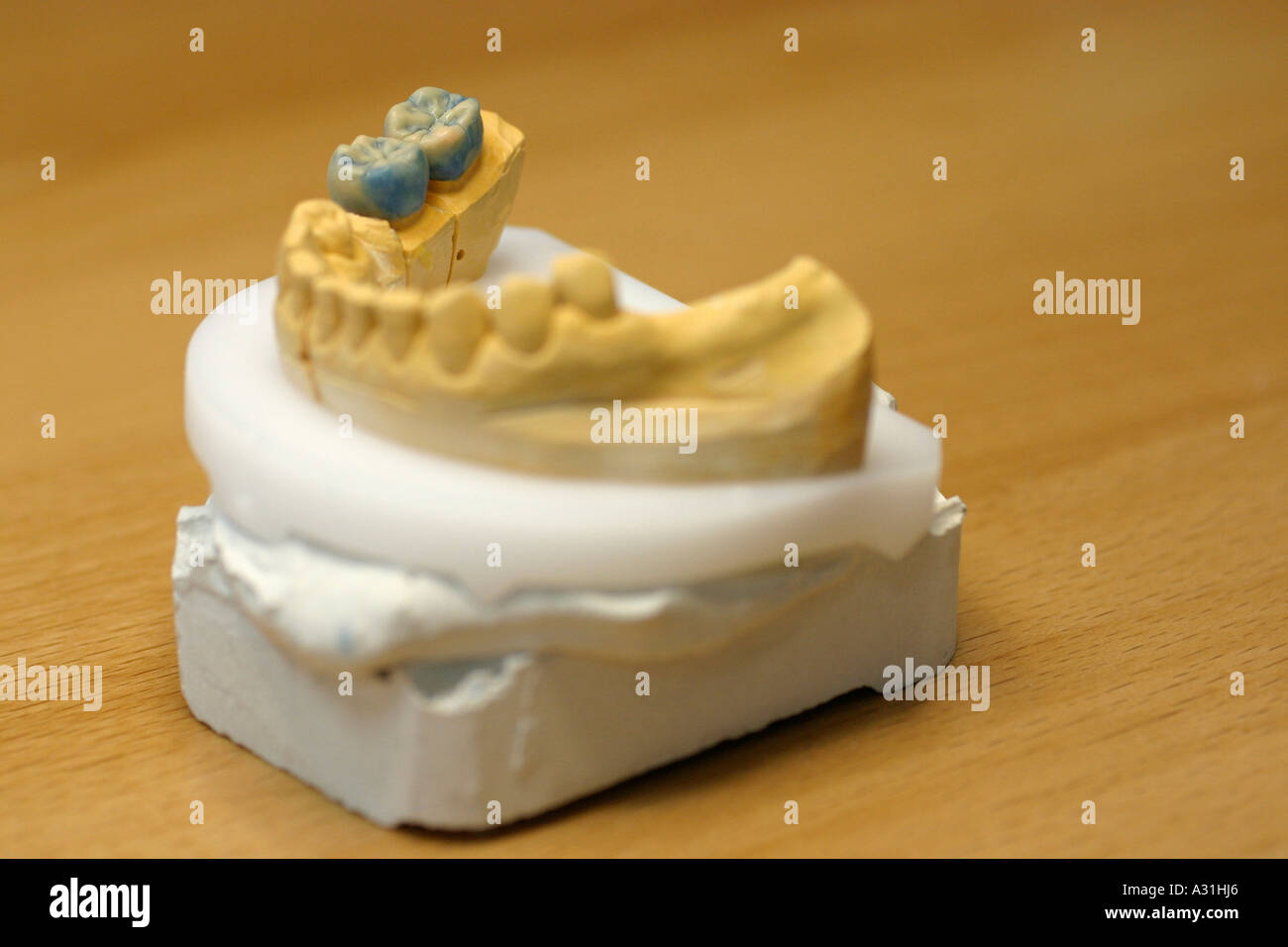 Yellow dental mould elevated view close up Stock Photo
