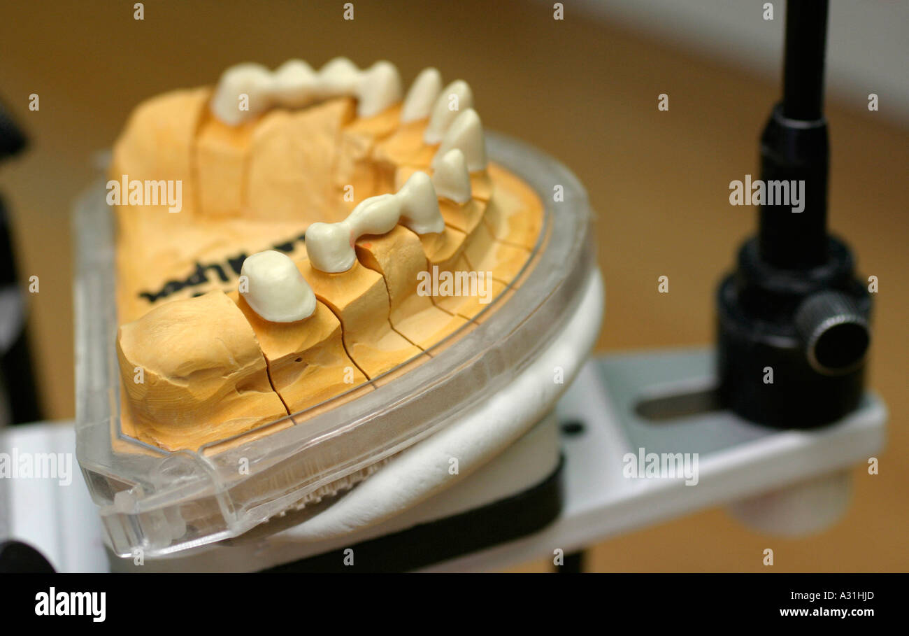 Dental mould in laboratory close up Stock Photo