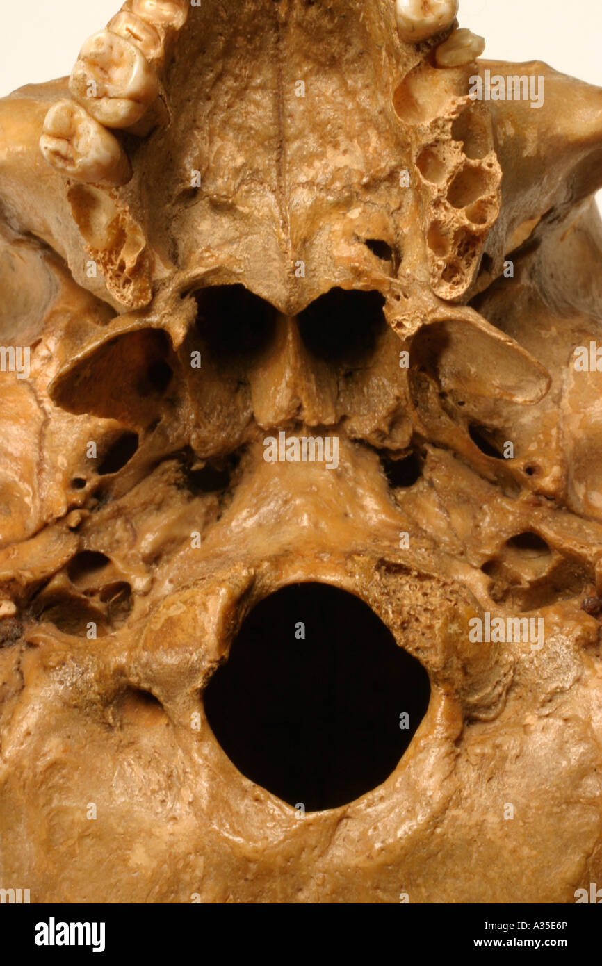 Palate structure hi-res stock photography and images - Alamy