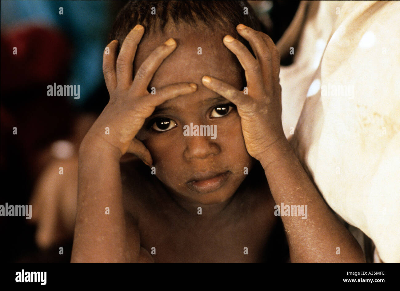 Sudan,famine,1985. Refugees from Ethiopia at Girba Camp on the border between Ethiopia and Sudan. Stock Photo