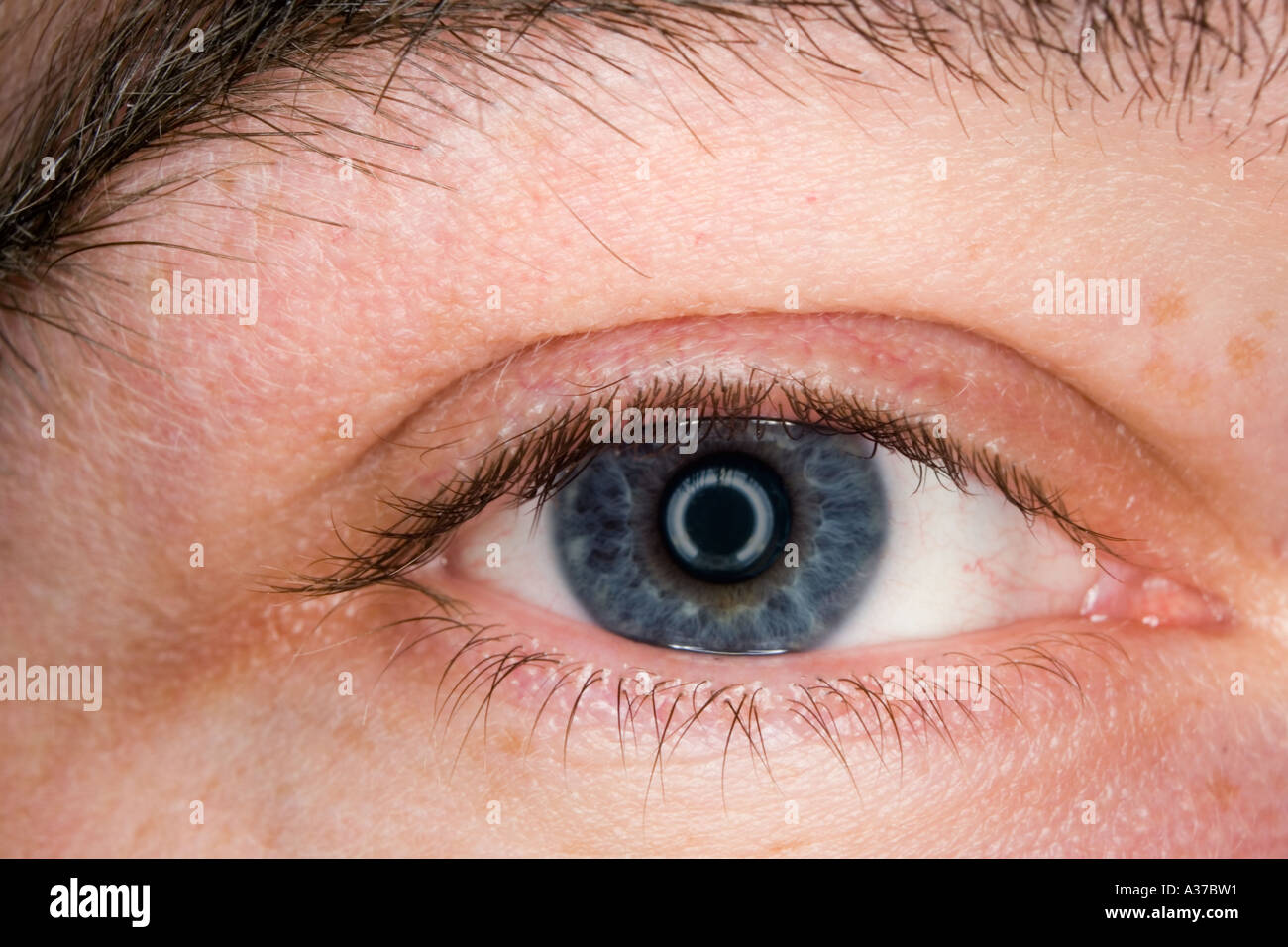 Is it normal for a black person to have a blue ring around their brown eyes?  - Quora