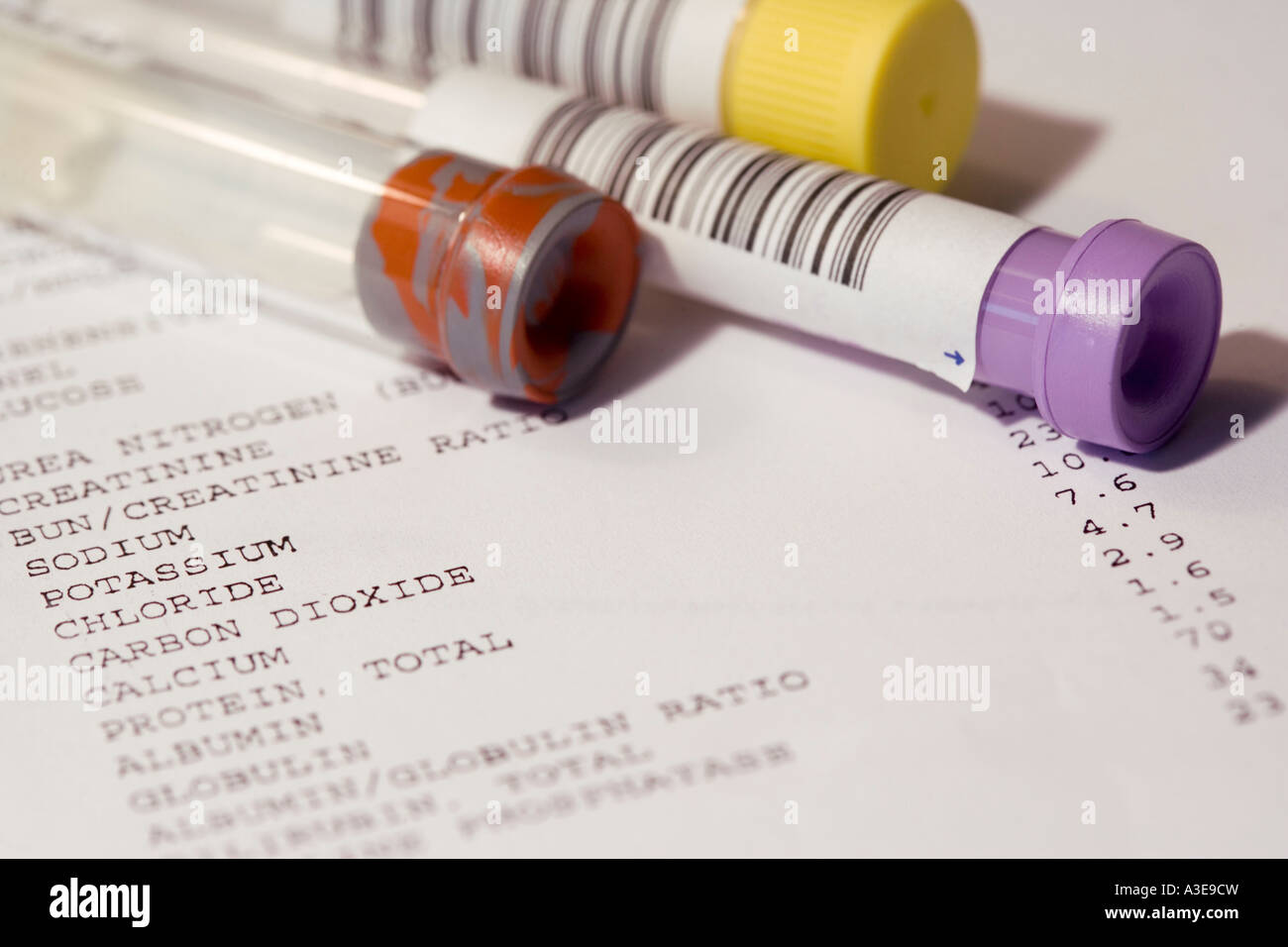 Blood test results hires stock photography and images Alamy