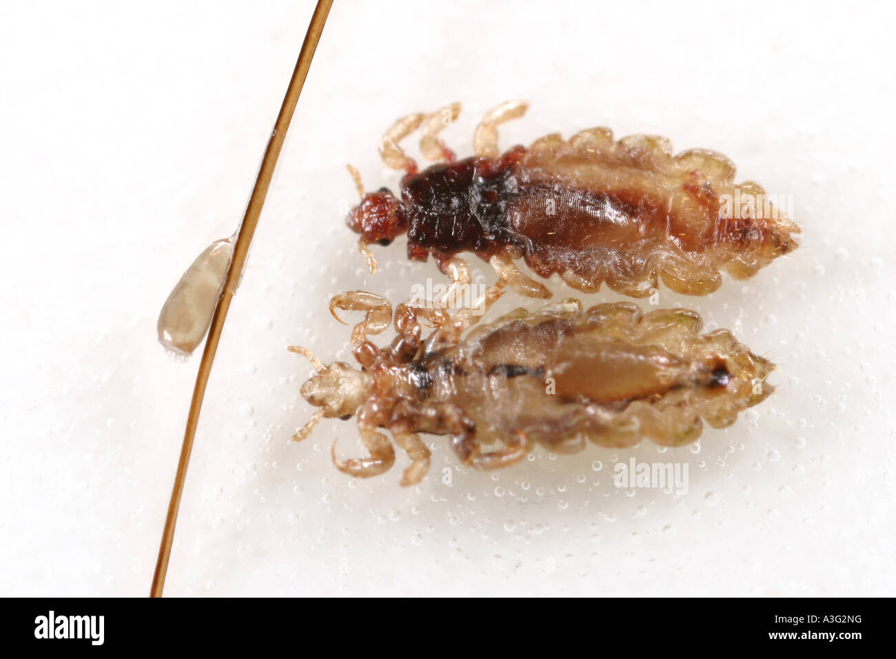 A pair of dead head lice and egg on human hair. Stock Photo