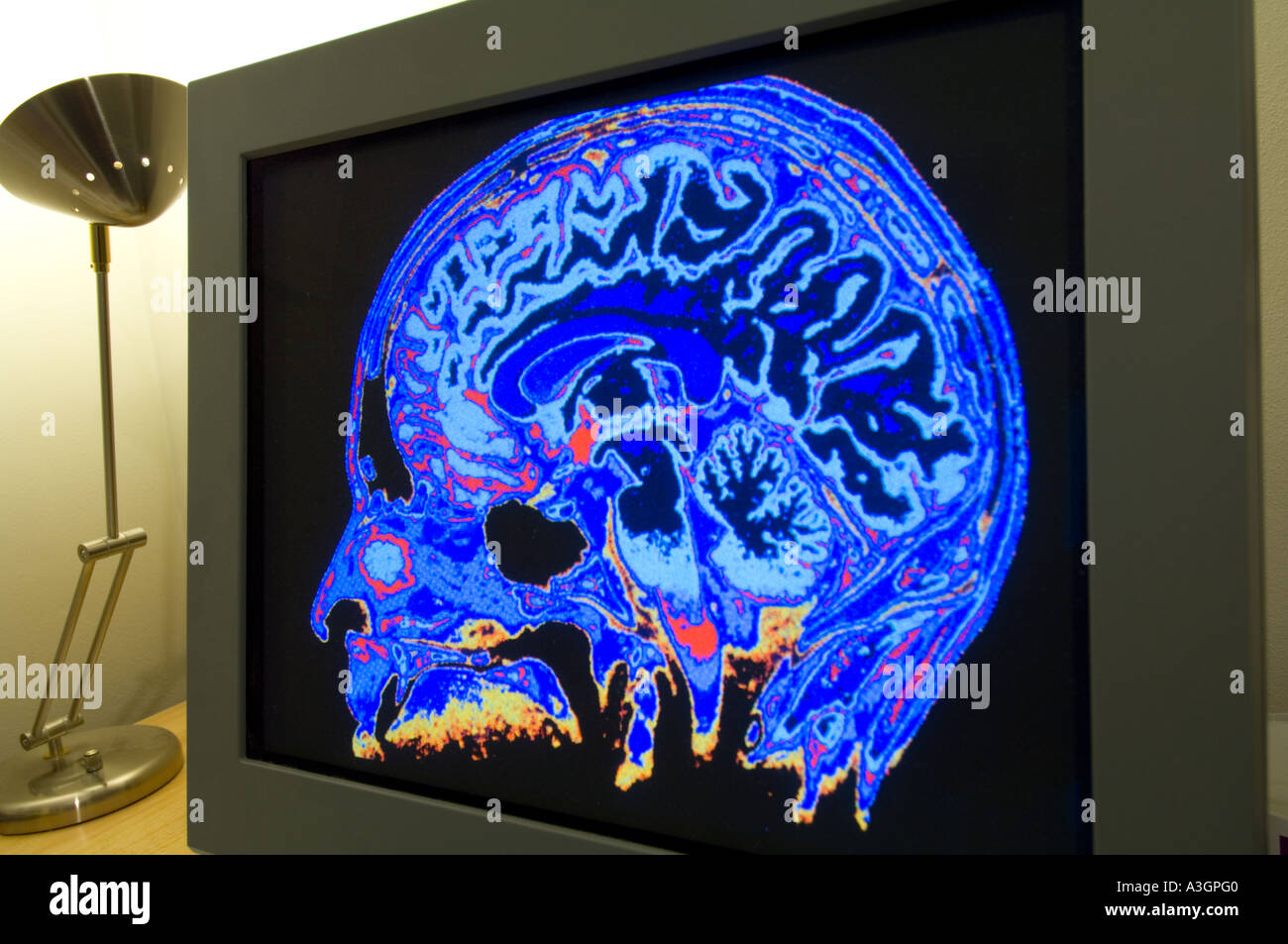 Skull image displayed in color on office computer screen Stock Photo ...