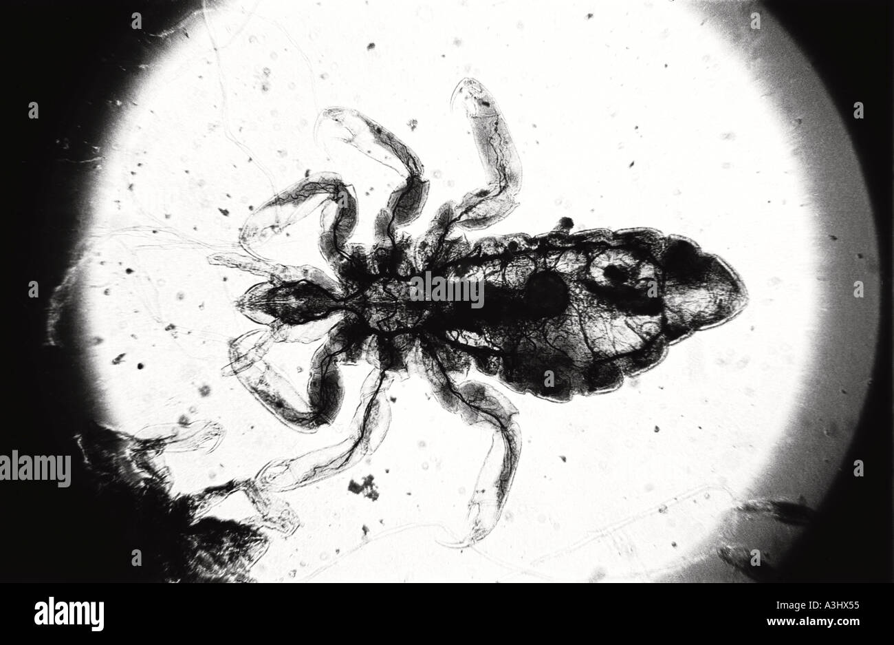 Pediculus humanus hi-res stock photography and images - Alamy