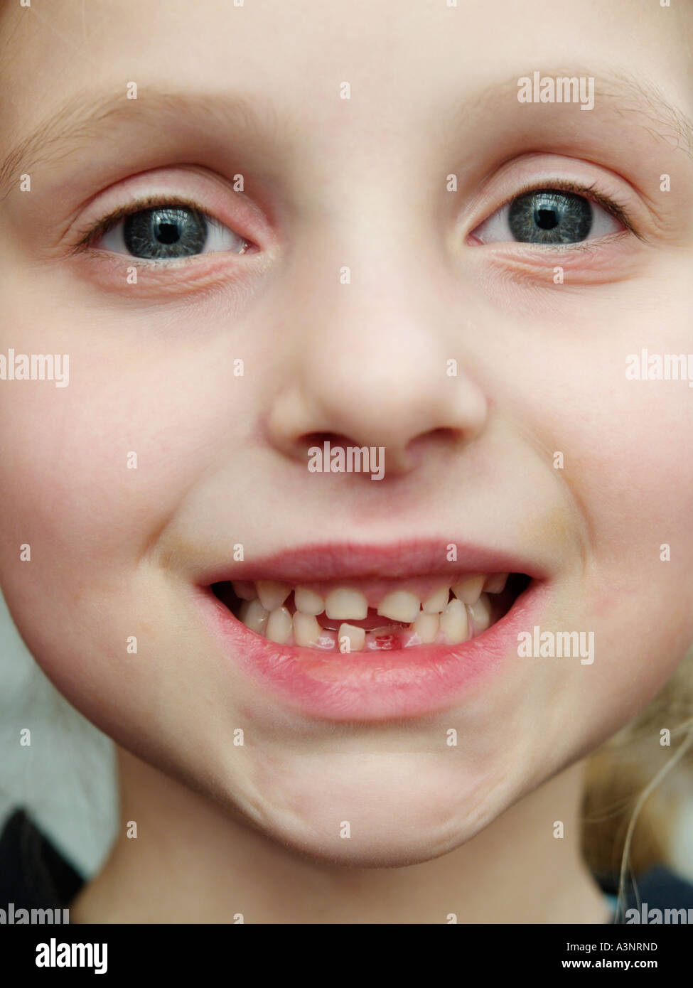 Portrait of proud little girl 5 five years old with first tooth that has fallen out  changing teeth shed tooth lost tooth Stock Photo