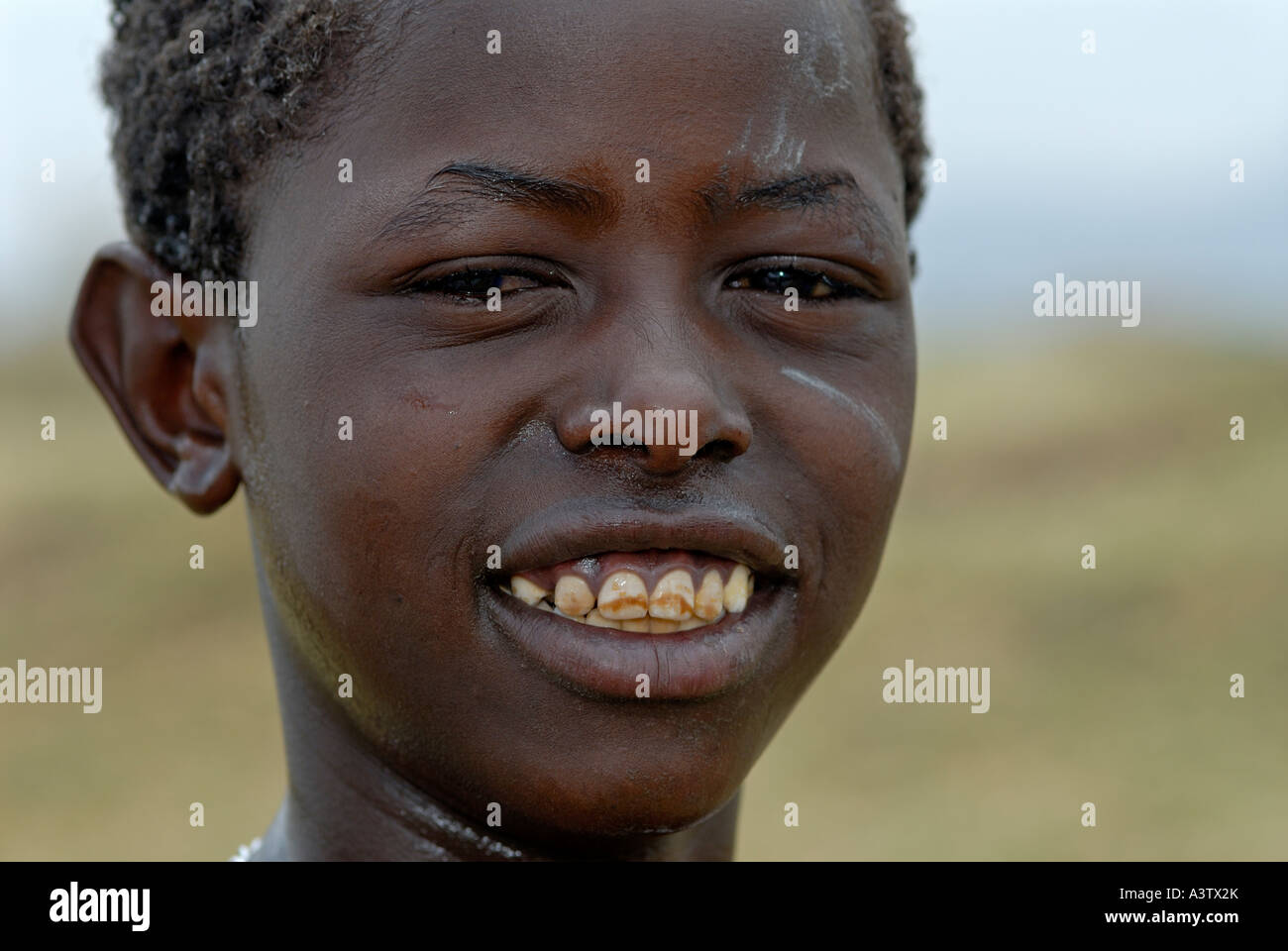 Smiling Kenyan boy with discolored teeth Lake Naivasha Kenya Stock